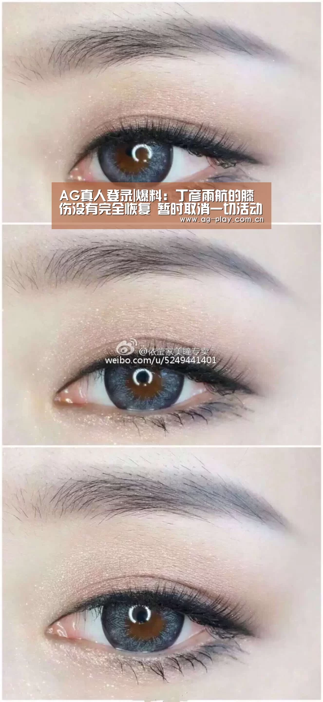 AG真人登录|爆料:丁彦雨航的膝伤没有完全恢复 暂时取消一切活动(图1) AG真人娱乐